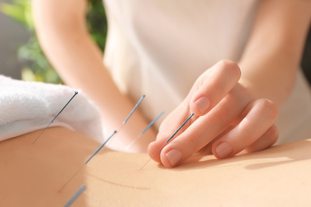 Acupuncture is Used More and More Across the World