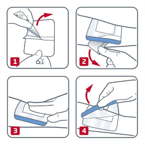 Instructions for sorbact wound dressing image