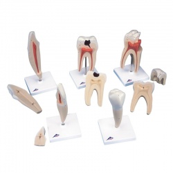 Classic Tooth Models (5 Options, 23 - 29cm)