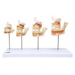 3B Scientific Dentition Development Model (Neonate - Young Adult)