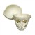 Erler-Zimmer Paediatric Skull Cast with Calvaria Cut (1-Year-Old)