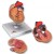 3B Scientific Heart Model with Left Ventricular Hypertrophy (2-Part)