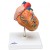 3B Scientific Heart Model with Left Ventricular Hypertrophy (2-Part)