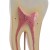 Molar and Incisor Tooth Models