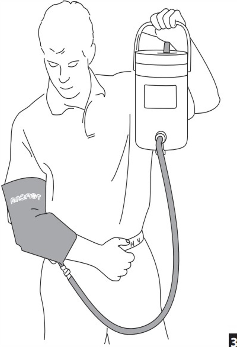 Aircast Ankle Cold Therapy Cryo/Cuff - MedicalSupplies.co.uk