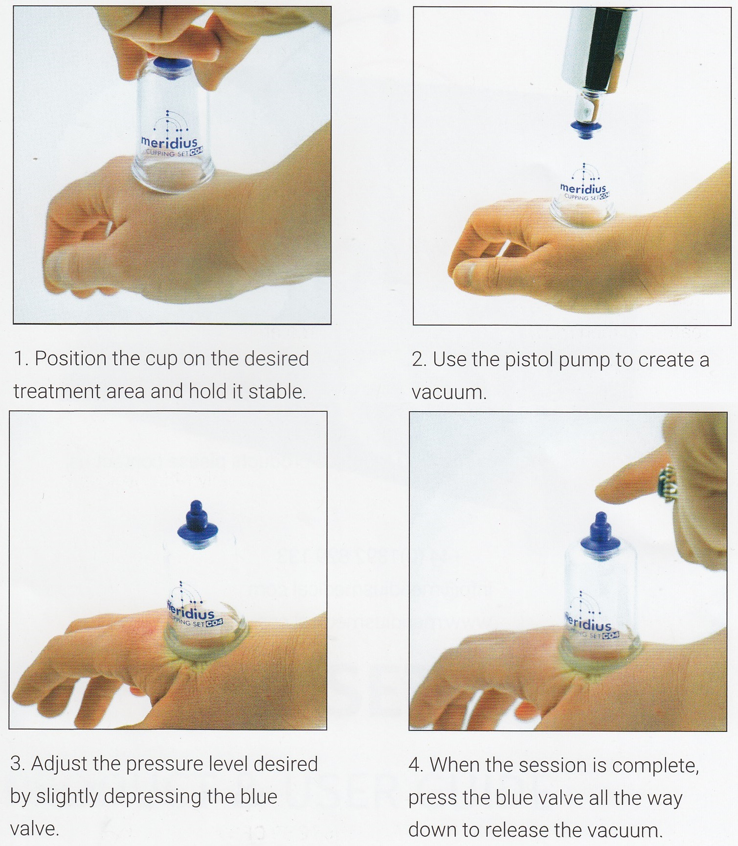 How to perform cupping therapy with the Meridius Cupping Set How To Perform Cupping Therapy With The Meridius Cupping Set