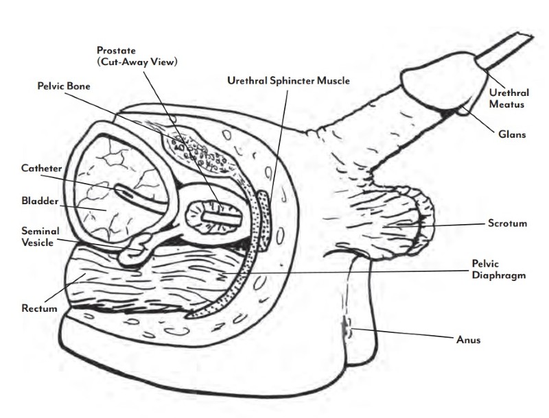 Male Catheter Insertion Diagram