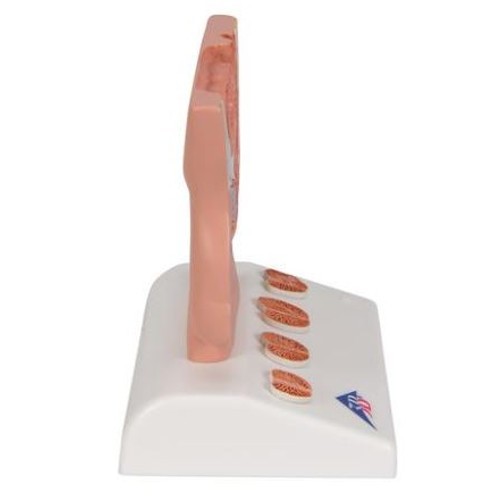 3B Scientific Anatomical Prostate Model - MedicalSupplies.co.uk