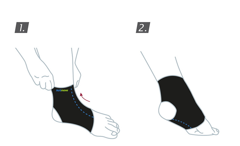 Application of the Actimove Ankle Brace for Kids