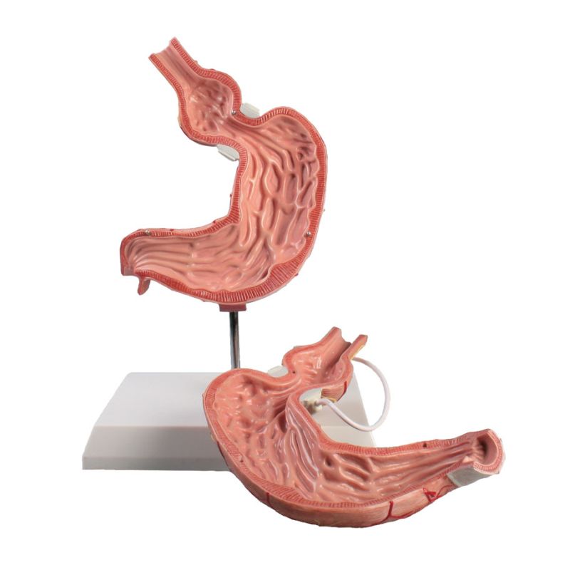 ErlerZimmer Anatomical Stomach Model MedicalSupplies.co.uk