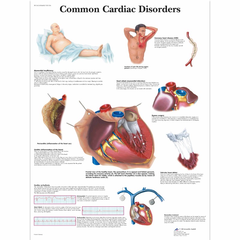 3B Cardiac Disorders Chart (Paper) - MedicalSupplies.co.uk