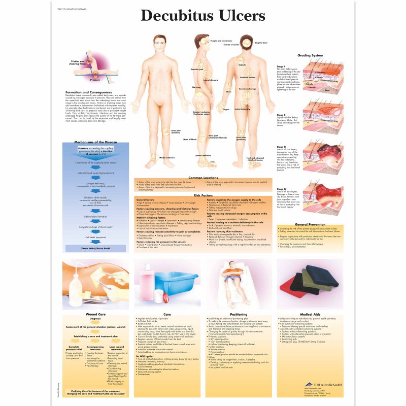 Decubitus Ulcers Chart MedicalSupplies.co.uk