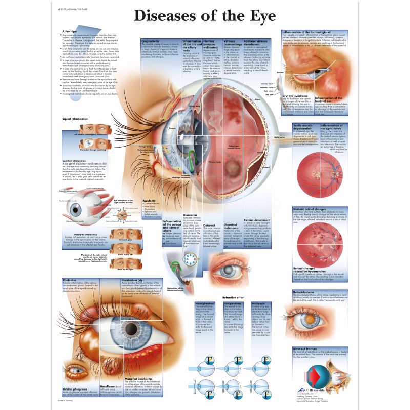Diseases of the Eye Chart MedicalSupplies.co.uk