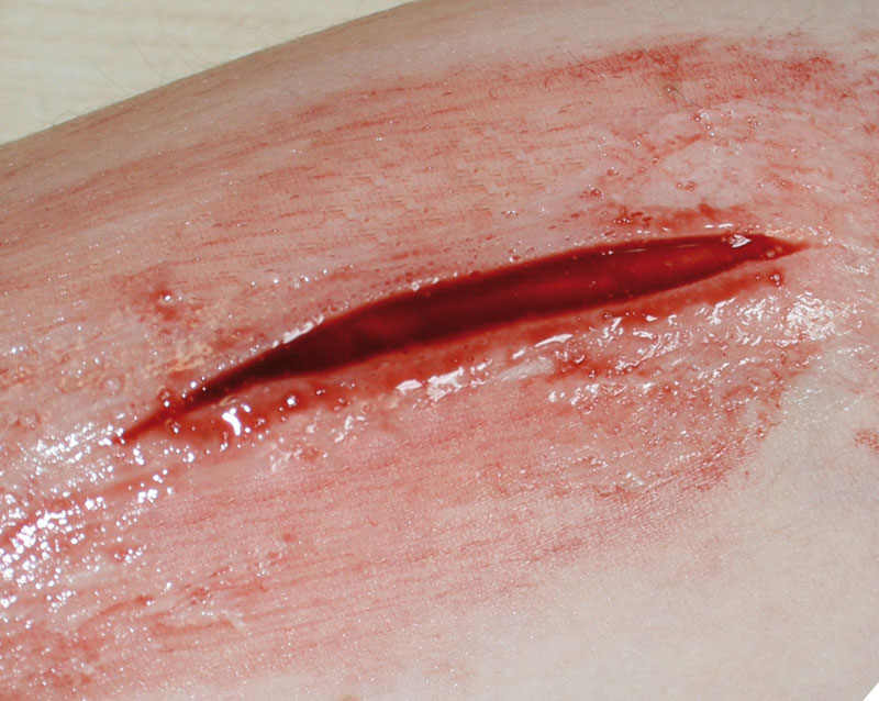 Close-up of a fake Wound