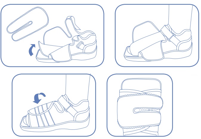 Instruction For Applying and Wearing Post-Operative Shoe 