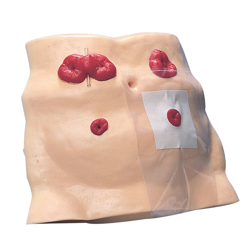Ostomy Care Model MedicalSupplies.co.uk