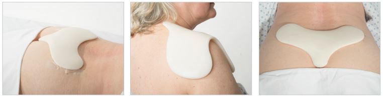 The DermisPlus Sacrum Pad can be used to relieve a number of areas Sacrum Pad in Use