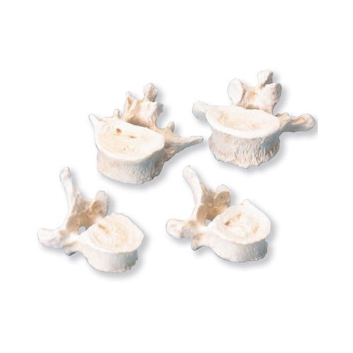 Set of 24 BONElike Vertebrae Models - MedicalSupplies.co.uk