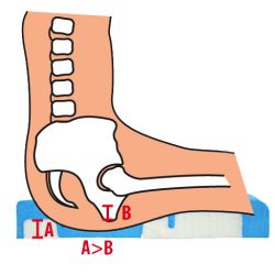 systam viscoflex plus bariatric insert ischia ischum