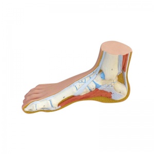 Normal, Hollow and Flat Foot Structure Model