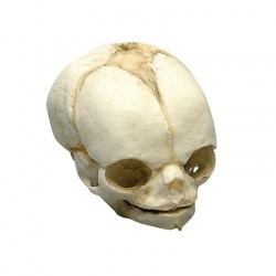 Erler-Zimmer Fetal Skull Model (21 1/2 Weeks)