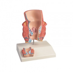 Erler-Zimmer Anatomical Haemorrhoids Model
