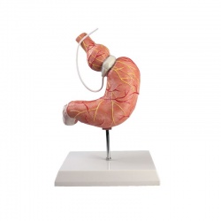 Erler-Zimmer Anatomical Stomach Model with Gastric Band