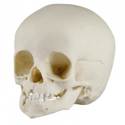 Erler-Zimmer Paediatric Skull Cast (14-Month-Old)