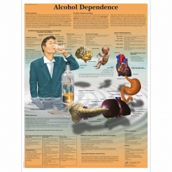Alcohol Dependence Chart