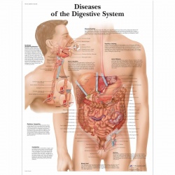 Diseases of the Digestive System Chart