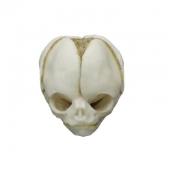 Erler-Zimmer Fetal Skull Model (20 Weeks)