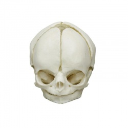 Erler-Zimmer Fetal Skull Model (29 Weeks)