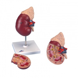 Kidney Model with Adrenal Gland (2-Part)