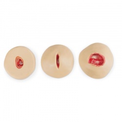 Erler-Zimmer Negative Pressure Wound Therapy (NPWT) Simulators - Set of 3