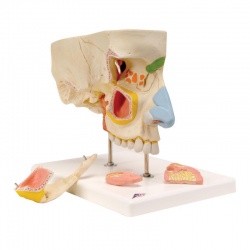 Nose Model with Paranasal Sinuses (5-Part)