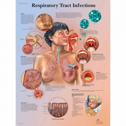 Respiratory Tract Infections Chart