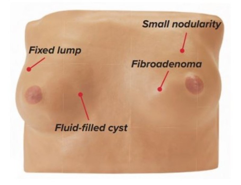 Simulaids Breast Examination Device Abnormality Diagram